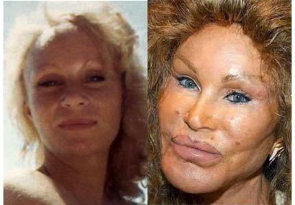 jocelyn_wildenstein-40034c20